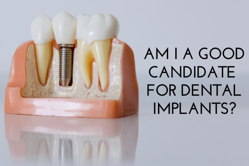 Am I a Good Candidate for Dental Implants?